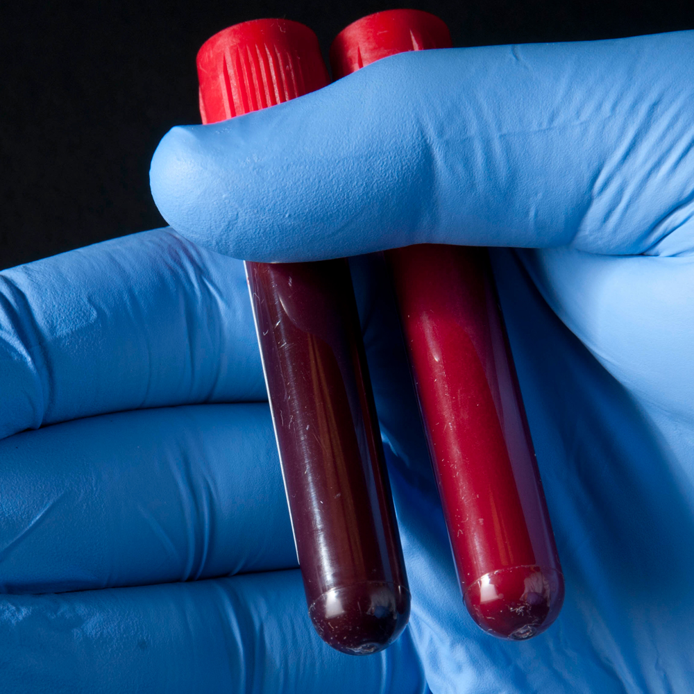 Lipsa-oxigenului-in-organism